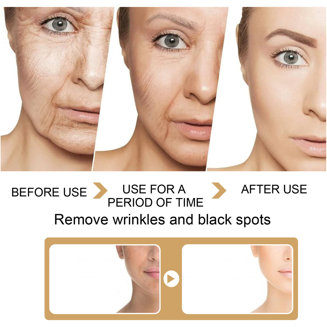 Black Spot Removal Serum